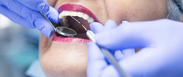 Best Emergency Treatment for Dental Infections or Abscesses in Deville, AL
